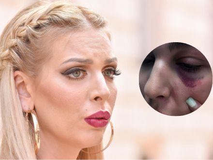 Ava Karabatić obnovila vezu sa zaručnikom nakon teških optužbi i prijava policiji