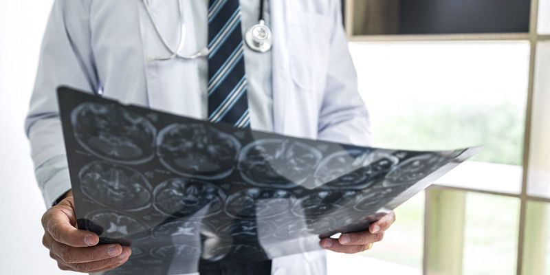 Dr. Vesna Arsić Pejić: Pravovremenom reakcijom i prevencijom moguće spriječiti do 80 posto moždanih udara