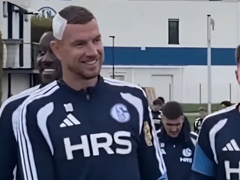 Džeko trenirao s flasterom na glavi: Muslić pred gostovanje Kolnu suočen s dobrim i lošim vijestima