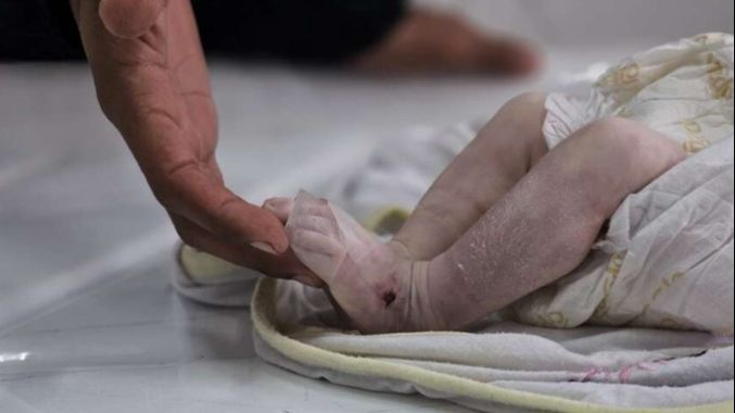 Tragedija u Zrenjaninu: Preminula beba, naložena obdukcija