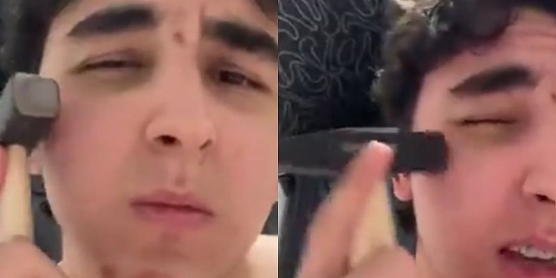 Opasan trend u Rusiji: Više od stotinu mladića povrijeđeno udaranjem čekićem u lice