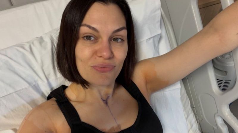 Britanska pjevačica Jessie J podijelila detalje oporavka nakon druge rekonstruktivne operacije